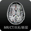 影像解剖图谱app免费下载-医学影像解剖图谱电子版软件免费下载安装 v4.5.8安卓版
