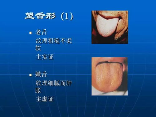 中医舌诊图解大全最新版v2.4安卓版下载:全面解析舌诊技巧与软件教程